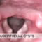 Surgery